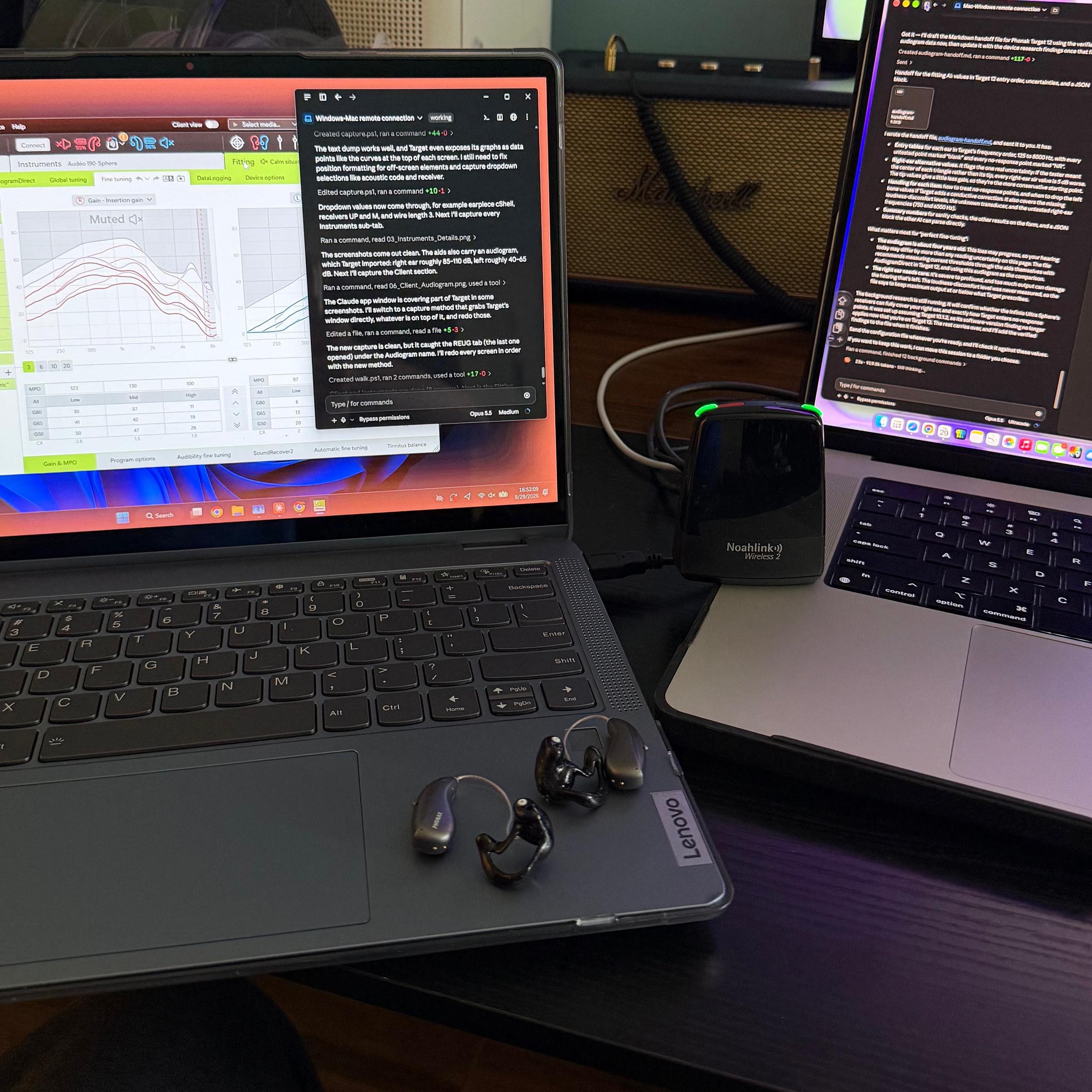 A Lenovo Windows laptop running Phonak Target 12.0.1 with a Claude window on top, a MacBook beside it running the supervising Claude session, a Noahlink Wireless 2 programming dongle between them, and two Phonak Audeo Sphere hearing aids with black custom shells on the Lenovo palm rest.